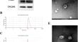 Signature and function of plasma exosome-derived circular RNAs in patients with hypertensive intracerebral hemorrhage.