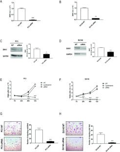 Dickkopf-1 (DKK1) drives growth and metastases in castration-resistant prostate cancer