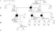 The response of pancreatic acinar cell carcinoma to platinum and olaparib therapy in a germline BRCA2 variant carrier: case report and literature review.