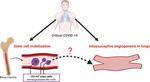 The Onset of Intussusceptive Angiogenesis in COVID-19 Patients Might Come from the Mobilization of Stem Cell Sub-Populations Expressing the Hemangioblast Marker CD143.