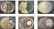 Augmentation in fragrant agarwood oil quality by fermentation with a microbial consortium of bacterium (Microbacterium oxydans) and fungus (Penicillium aethiopicum)