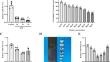 MicroRNA-451 Regulates Angiogenesis in Intracerebral Hemorrhage by Targeting Macrophage Migration Inhibitory Factor.