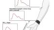 Comparing the compensatory reserve metric obtained from invasive arterial measurements and photoplethysmographic volume-clamp during simulated hemorrhage.