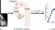 Longitudinal aortic strain, ventriculo-arterial coupling and fatty acid oxidation: novel insights into human cardiovascular aging.