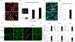 Characteristics of nuclear architectural abnormalities of myotubes differentiated from Lmna<sup>H222P/H222P</sup> skeletal muscle cells.