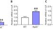 Blocking H<sub>1</sub>R signal aggravates atherosclerosis by promoting inflammation and foam cell formation.