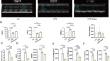 Dapagliflozin attenuates LPS-induced myocardial injury by reducing ferroptosis.