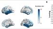 The Relationship between History of Traumatic Brain Injury and Longitudinal Changes in Cortical Thickness among Patients with Alzheimer’s Disease