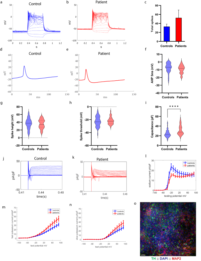 Upregulated ECM genes and increased synaptic activity in Parkinson’s human DA neurons with PINK1/ PRKN mutations