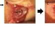 Evaluating osteogenic potential of a 3D-printed bioceramic-based scaffold for critical-sized defect treatment: an in vivo and in vitro investigation.