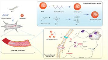 Nanoparticles targeting OPN loaded with BY1 inhibits vascular restenosis by inducing FTH1-dependent ferroptosis in vascular smooth muscle cells