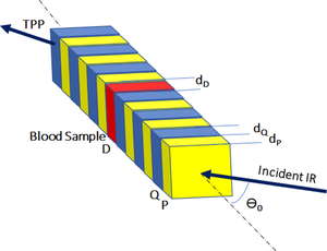 Enhanced 1D photonic crystal biosensor for blood components and blood infection detection