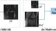 Deep learning-based magnetic resonance image super-resolution: a survey