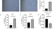 Senescence of endothelial cells promotes phenotypic changes in adventitial fibroblasts: possible implications for vascular aging.