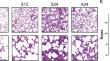 Inhibition of cIAP1/2 reduces RIPK1 phosphorylation in pulmonary endothelial cells and alleviate sepsis-induced lung injury and inflammatory response.