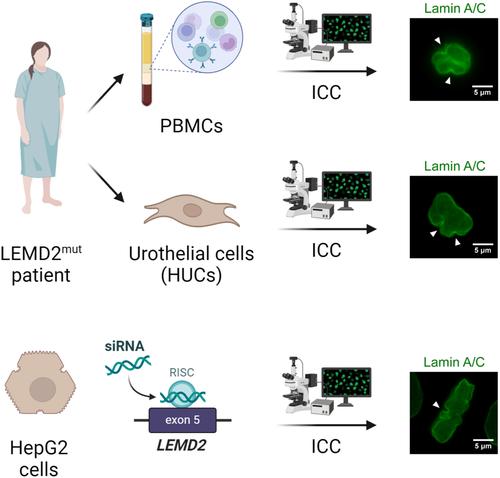 LEMD2-associated progeroid syndrome: Expanding the phenotype of the nuclear envelopathy caused by a defect in LEMD2 gene