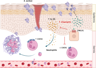 Chemerin is a key player in antimicrobial defense in skin