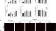 Induction of Peroxiredoxin 1 by Hypoxia Promotes Cellular Autophagy and Cell Proliferation in Oral Leukoplakia via HIF-1α/BNIP3 Pathway.