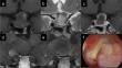 Appearance of fluid content in Rathke's cleft cyst is associated with clinical features and postoperative recurrence rates.