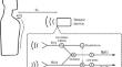 Validation of the Sleepiz One + as a radar-based sensor for contactless diagnosis of sleep apnea.