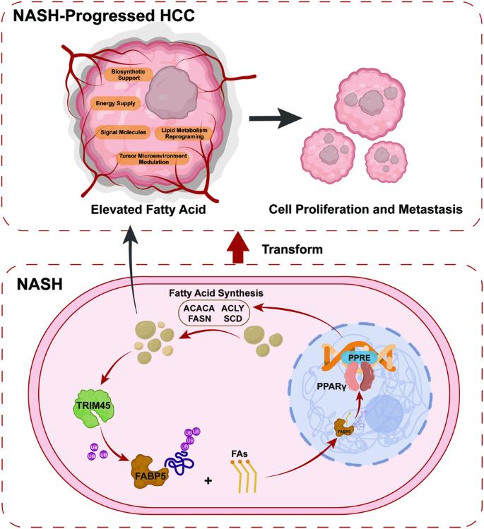 TRIM45 facilitates NASH-progressed HCC by promoting fatty acid synthesis via catalyzing FABP5 ubiquitylation