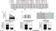 SPG21, a potential oncogene targeted by miR-128-3p, amplifies HBx-induced carcinogenesis and chemoresistance via activation of TRPM7-mediated JNK pathway in hepatocellular carcinoma.