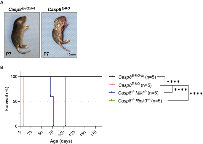 The importance of murine phospho-MLKL-S345 in situ detection for necroptosis assessment in vivo