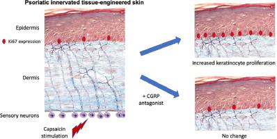 Sensory neurons increase keratinocyte proliferation through CGRP release in a tissue engineered in vitro model of innervation in psoriasis