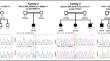 Exome sequencing in four families with neurodevelopmental disorders: genotype-phenotype correlation and identification of novel disease-causing variants in VPS13B and RELN.