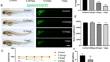 Isavuconazole Induces Neurodevelopment Defects and Motor Behaviour Impairment in Zebrafish Larvae.