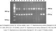 Milk supply chain as a reservoir of antimicrobial-resistant Staphylococcus species