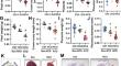 Activation of lipophagy ameliorates cadmium-induced neural tube defects via reducing low density lipoprotein cholesterol levels in mouse placentas.