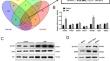 PDLIM3 knockdown promotes ferroptosis in endometriosis progression via inducing Gli1 degradation and blocking Hedgehog signaling pathway.