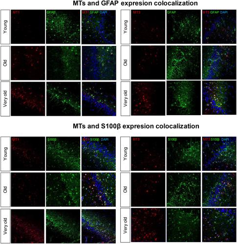 Centenarian hippocampus displays high levels of astrocytic metallothioneins