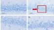 Glycyrrhizic Acid Alleviates Semen Strychni-Induced Neurotoxicity Through the Inhibition of HMGB1 Phosphorylation and Inflammatory Responses.