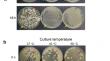 Competition between biodetoxification fungus and lactic acid bacterium in the biorefinery processing chain for production of cellulosic L-lactic acid.