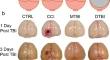 Traumatic brain injury heterogeneity affects cell death and autophagy.