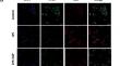 Angiotensin II Type 2 Receptor Inhibits M1 Polarization and Apoptosis of Alveolar Macrophage and Protects Against Mechanical Ventilation-Induced Lung Injury.