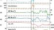 Differences in the characteristics and triggering mechanisms of two successive AL index onsets on 21st January 2005