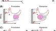 A computational neural model that incorporates both intrinsic dynamics and sensory feedback in the Aplysia feeding network.