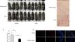 LncRNA RP11-818O24.3 promotes hair-follicle recovery via FGF2-PI3K/Akt signal pathway