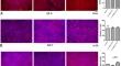 Identification of established and novel extracellular matrix components in glioblastoma as targets for angiogenesis and prognosis.