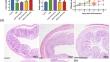 4-Octyl itaconate alleviates dextran sulfate sodium-induced ulcerative colitis in mice via activating the KEAP1-NRF2 pathway.