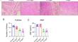 Omaveloxolone Prevents Polystyrene Microplastic-Induced Ovarian Granulosa Cell Apoptosis via the Keap1/Nrf2/HO-1 Pathway in Rats.