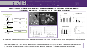 Percutaneous Fixation with Internal Cemented Screws for Iliac Lytic Bone Metastases: Assessment of Pain and Quality of Life on Long Term Follow-up.