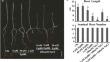 BR regulates wheat root salt tolerance by maintaining ROS homeostasis.