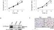 Vitamin D-metabolizing enzyme CYP24A1 affects oncogenic behaviors of oral squamous cell carcinoma and its prognostic implication.