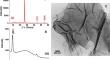 Improving the adsorption capacity of graphene oxide. Effect of Ca2+ on tetracycline retention