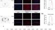 PRDX1 Interfering Peptide Disrupts Amino Acids 70-90 of PRDX1 to Inhibit the TLR4/NF-κB Signaling Pathway and Attenuate Neuroinflammation and Ischemic Brain Injury.