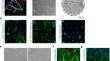 Generation and characterisation of scalable and stable human pluripotent stem cell-derived microvascular-like endothelial cells for cardiac applications